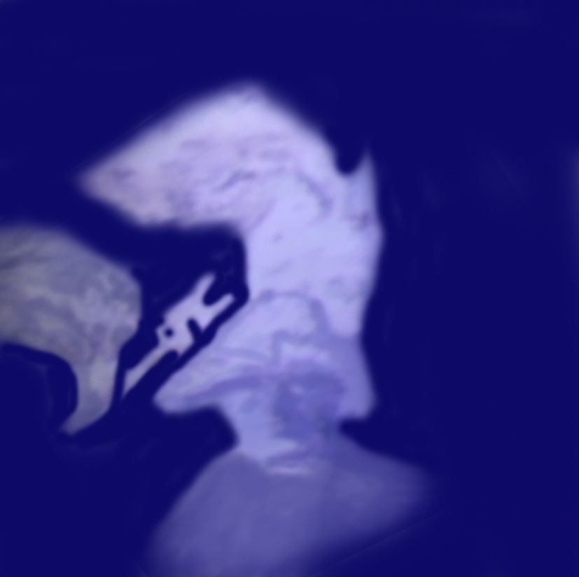 thumb2